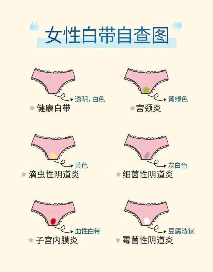 最新白带样本,最新白带样本，变化的力量与自信的光芒