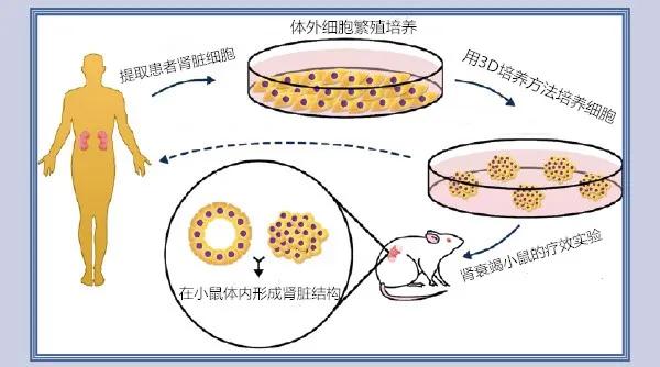 最新替代透析技术，神奇之旅启程